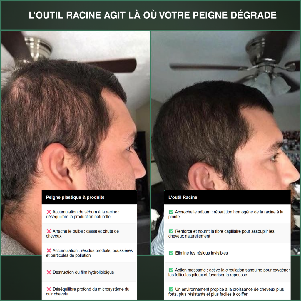 L'outil Racine
