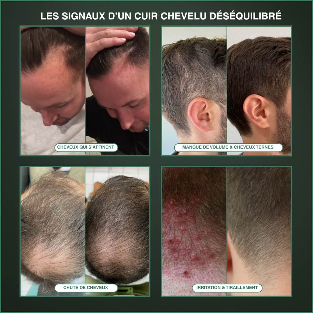 L'outil Racine