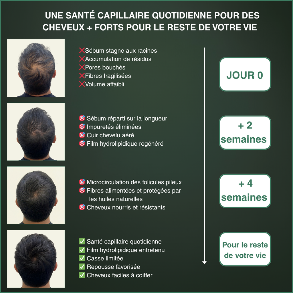 L'outil Racine