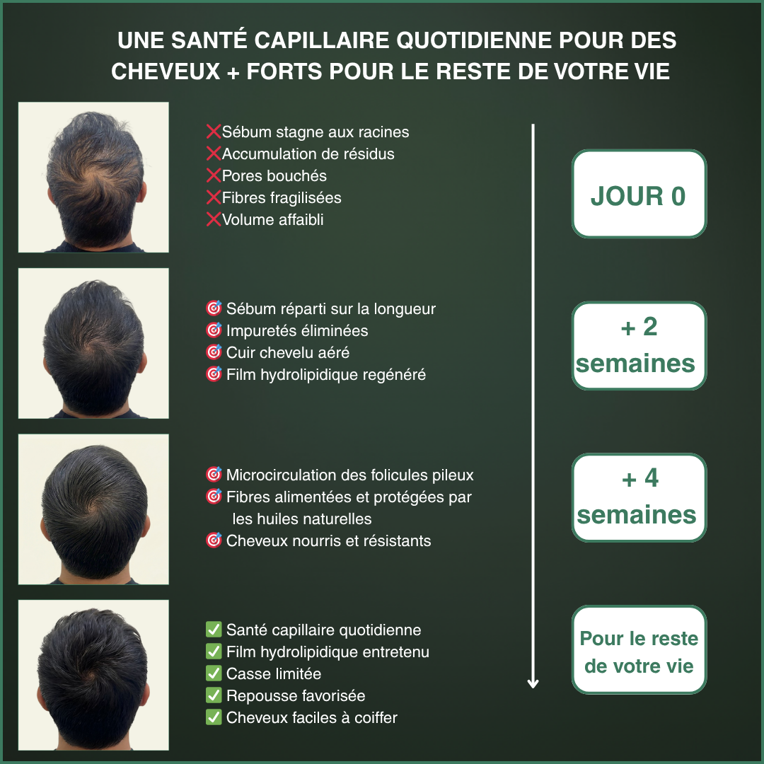 L'outil Racine